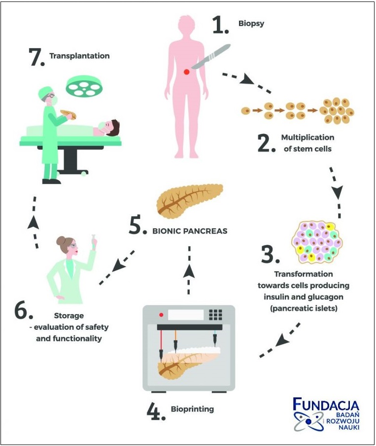 The process of the bionic pancreas. Image via Fundacja BIRN.