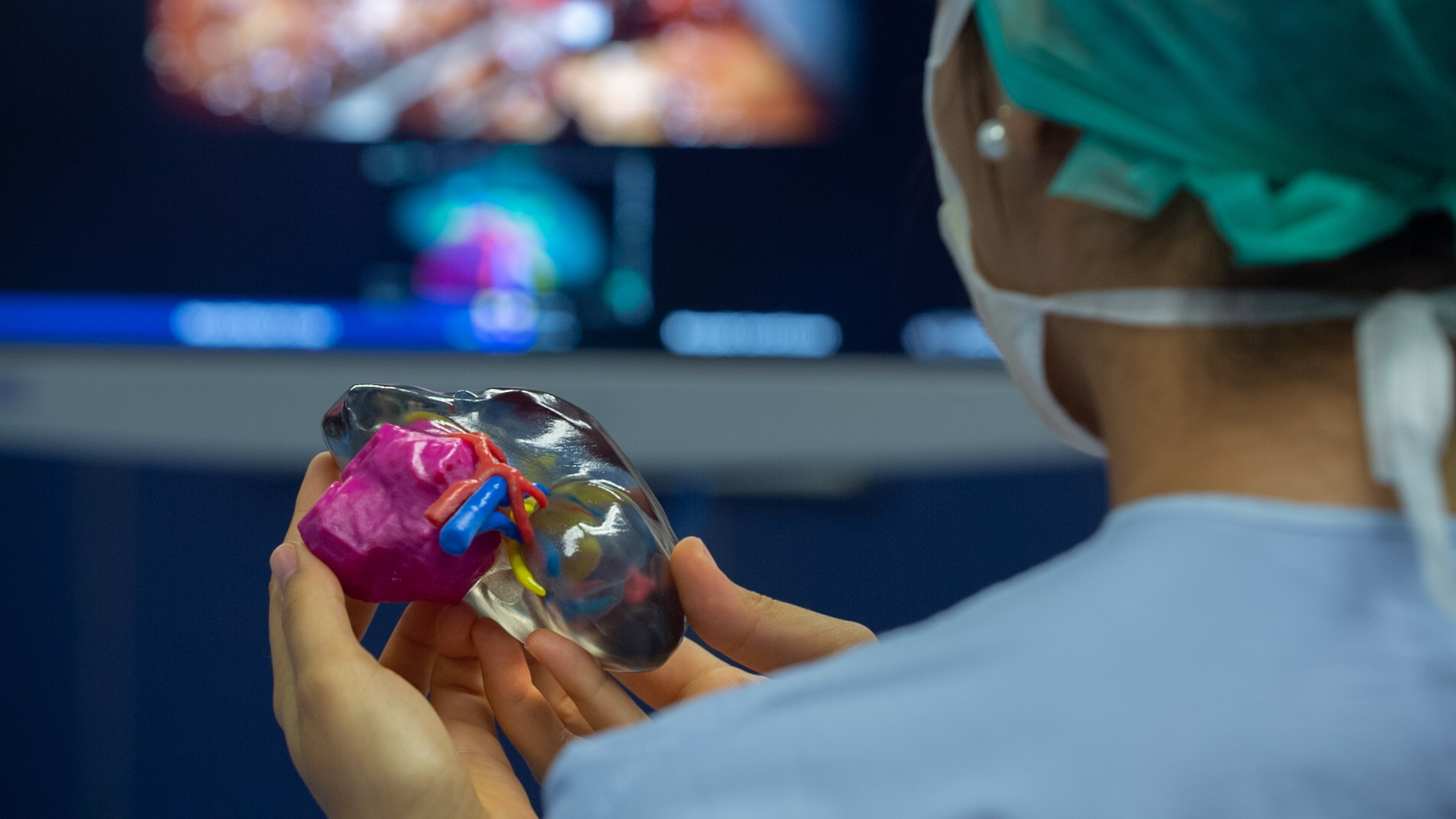 3D printed kidney tumor model used in pre-surgical planning. Photo via Stratasys