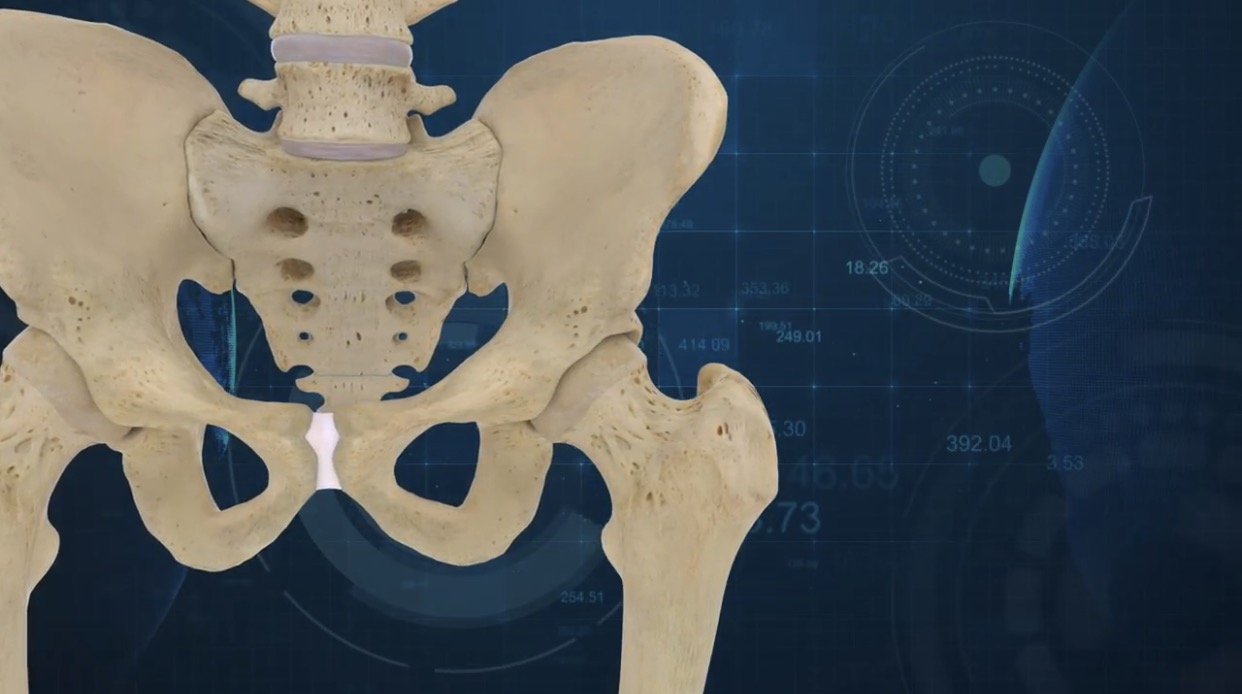 The ConforMIS Hip System imaging software. Image via ConforMIS.