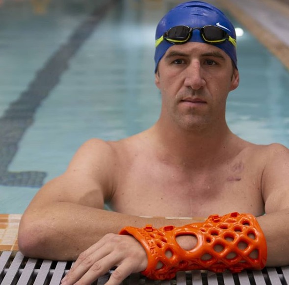 An ActivArmor 3D printed waterproof cast. Photo via ActivArmor.