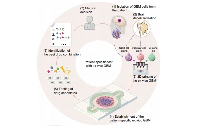 Schematic illustration of the bioprinting and use of the patient-specific GBM-on-a-chip for the identification of an optimal drug combination for the patient. Image via SNUH/POSTECH.