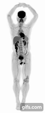 A 3D scan from the EXPLORER. Clip via UC Davis.