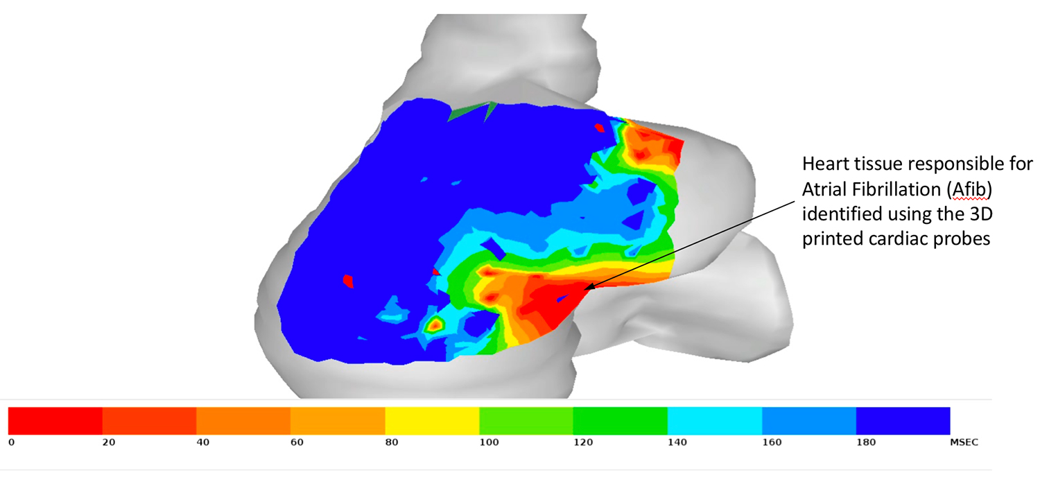 A heat map of the electrical activity of a heart projected onto a computer-simulated model of the right atrium. Image via Kevin Cyr.