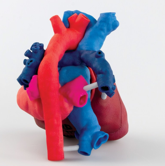 A 3D printed heart model. Photo via 3D Systems/OpHeart.