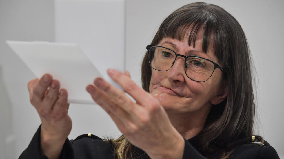 Denise Vicentin looks in the mirror for the first time after getting here new prosthesis. Photo via AFP.